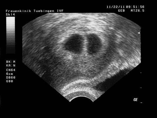 7. SSW, 6+4, am 22. November. 